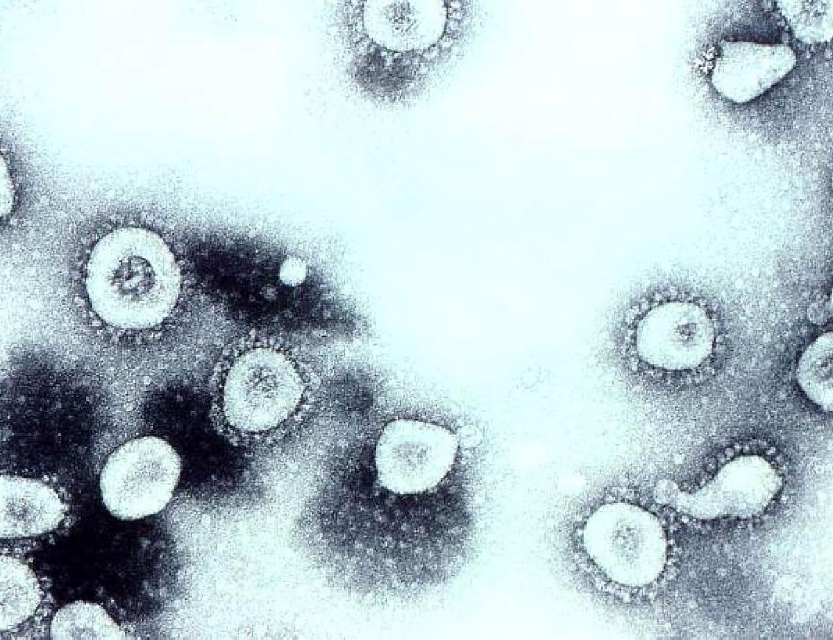 Coronavirus : la reconnaissance du cas de force majeure soulage la Ficime